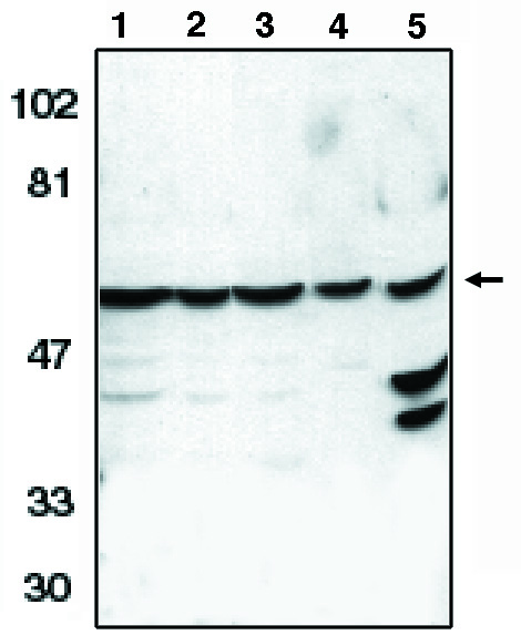 "
Western blot analysis
using anti-Caspase-10
(CT) antibody at 0.5 µg/ml on HeLa (1), Jurkat (2), A431 (3), K562 (4) and NIH3T3 (5) whole cell lysates."